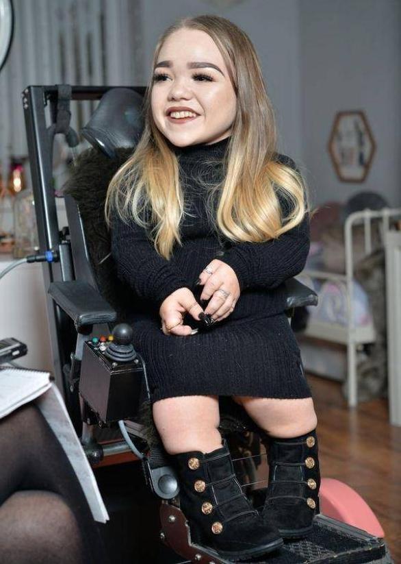 79厘米高的女孩却19岁了英国最小的成人会化妆成了网红