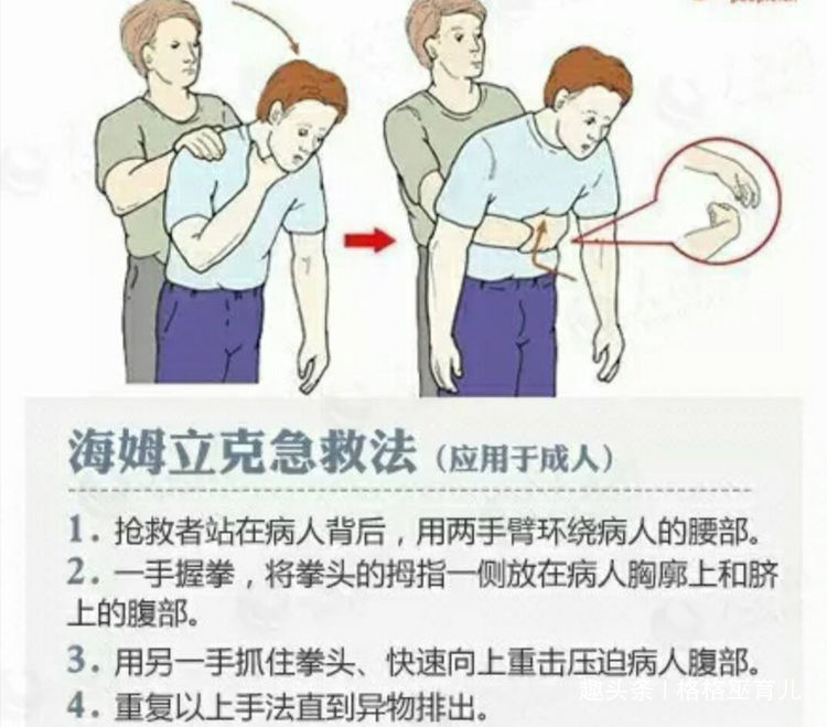 教你一分钟学会小儿哈姆立克法,相当实用的儿童急救法!