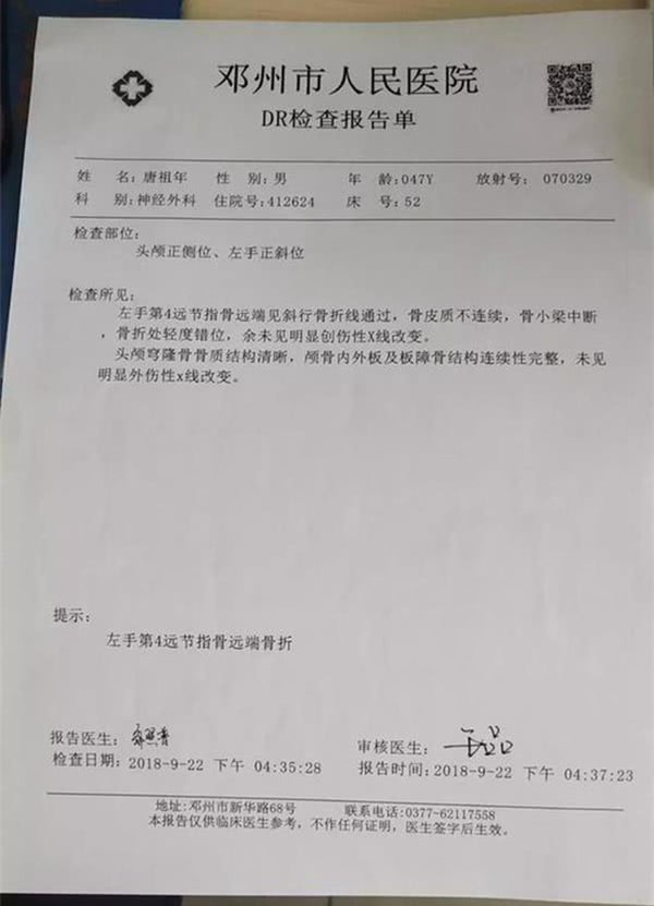 眉骨处有大约两厘米多的伤口,眼睛紫红,医生诊断为左手小指骨折变形