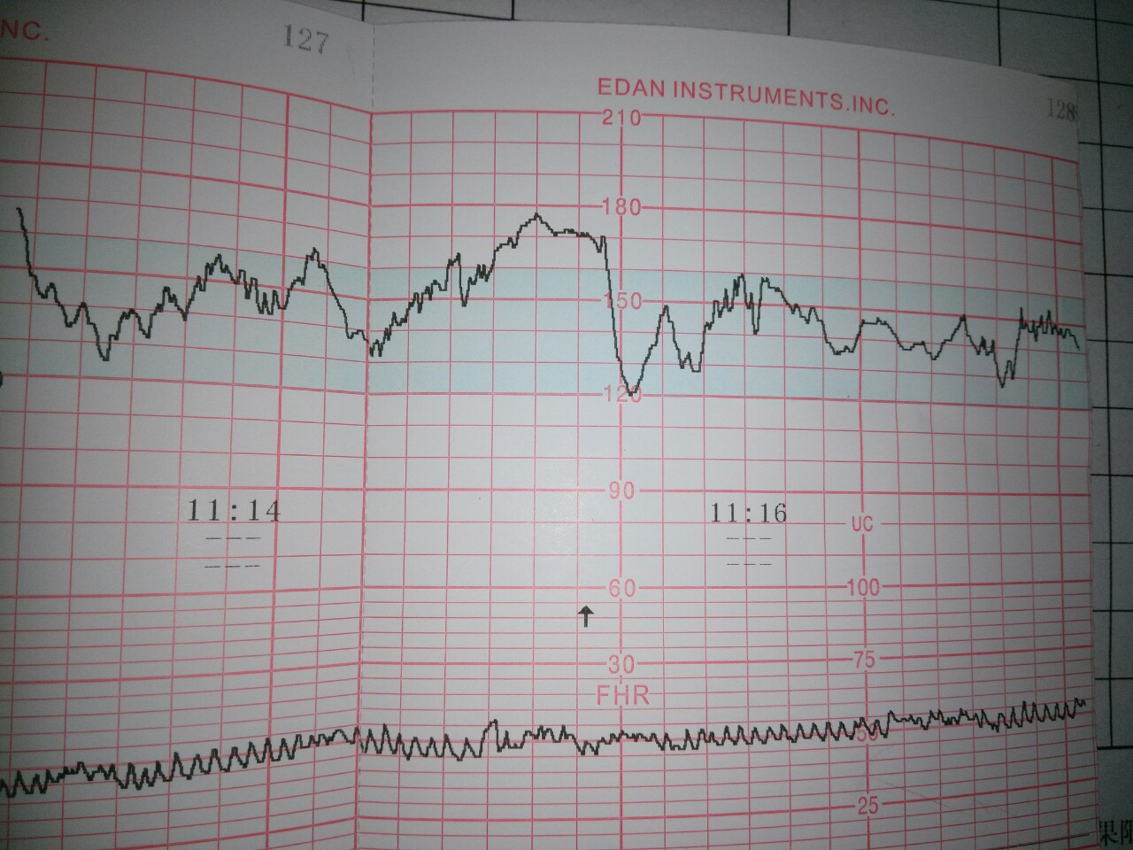 二是胎心监护胎心监护也是监测胎儿是否正常的,最重要的方式之一,胎