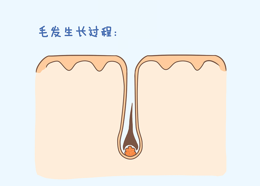 潮湿,而皮脂分泌的过程中产生的过量的物质又对毛囊有着毒害的作用