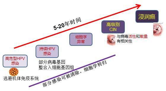 宫颈癌是这样"睡"出来的,2种睡法惹祸上身,清病毒高手来助力
