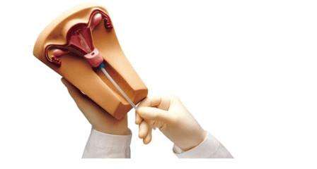 到了第二个月,我又来到了医院,医生让我上的是活形元宫环,当时医生