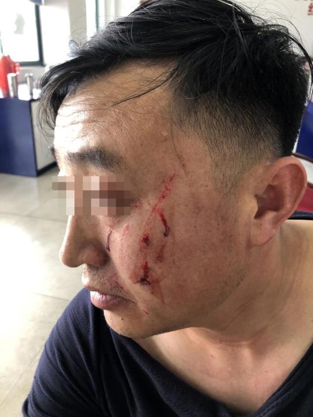 左一拳,右一脚,铁棍都用上了路怒症"司机一言不合高速上打架