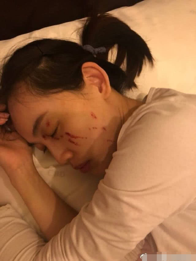 马蓉亲戚为她鸣不平,王宝强不念昔日夫妻感情,打人太凶狠