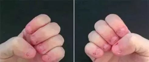 啃指甲,吃手,咬铅笔孩子小动作背后暗藏心理问题|指甲|手指|小动作