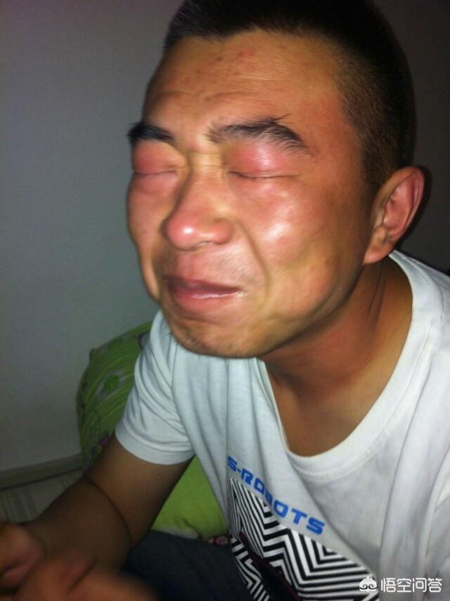 电焊打眼后的处理方法|电焊|清水|电光性眼炎_新浪新闻