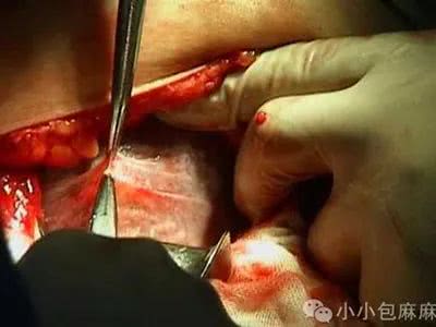 以下这些图可能会引起不适,但真实的一逼.