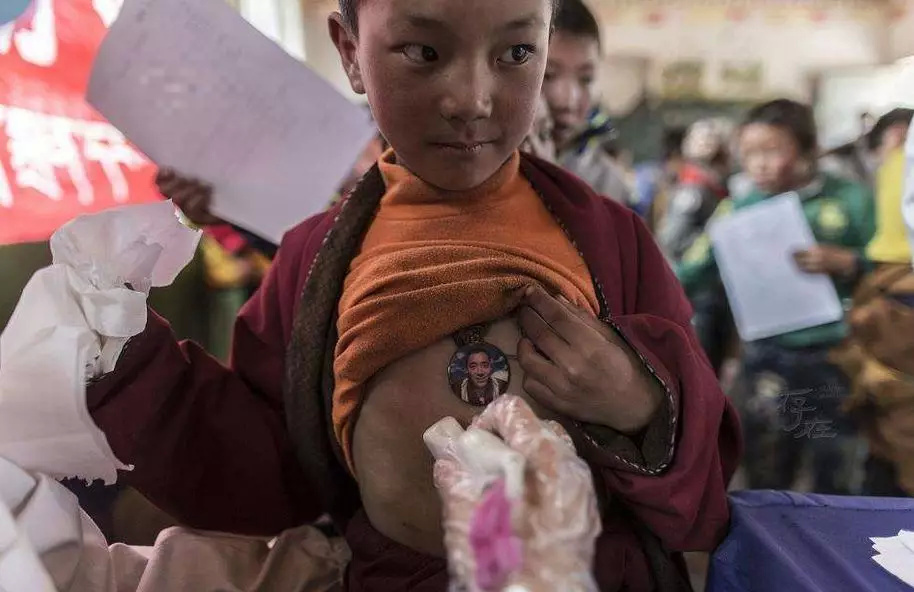 樊海宁一行人到达达日县进行义诊的时候13岁的小角吉已经是包虫病晚期