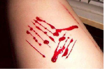 手臂割伤真实流血图片图片