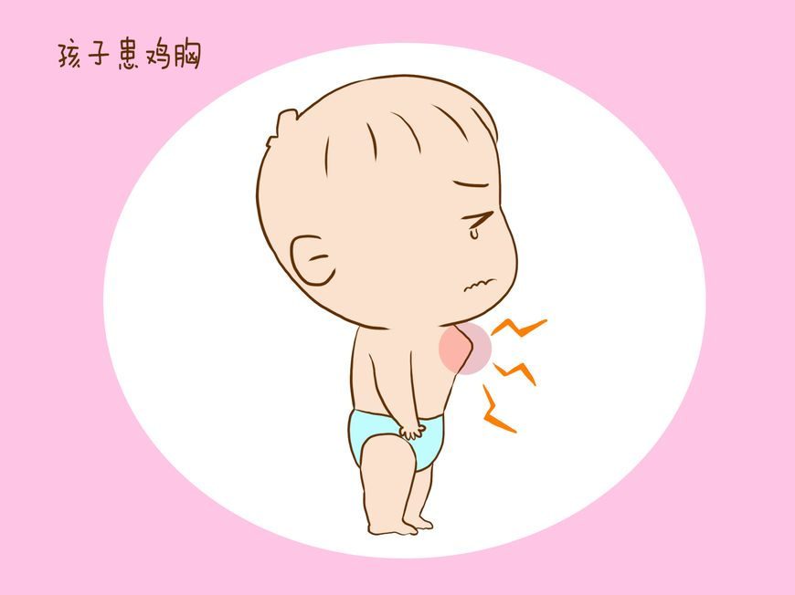 三岁儿童患鸡胸医生的一番话让宝妈难掩羞愧低下头