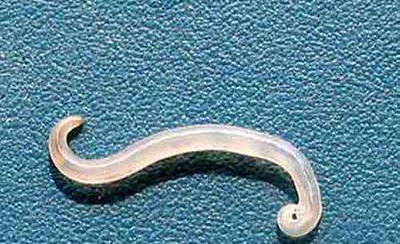 爱脱皮?|蛲虫病|蛲虫|脱皮_新浪新闻