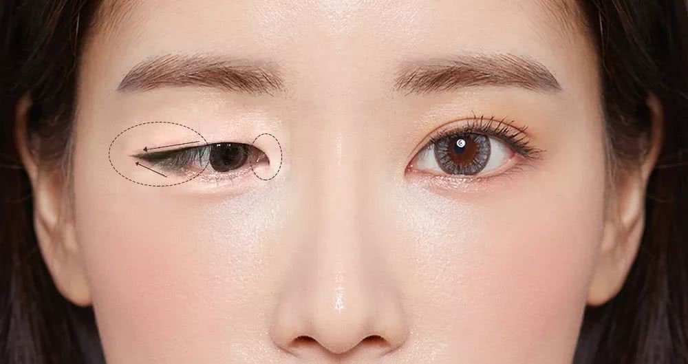 眼睛的大小是由双眼皮的宽度决定?