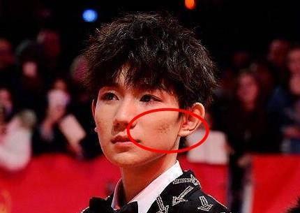 王源素颜拍电影一脸的痘痘,看到无修图下真实颜值,网友不淡定了