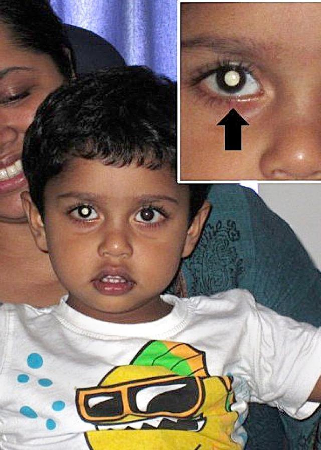 母亲给儿子拍照发现眼睛发白光, 拒绝医生建议竟发现致命疾病