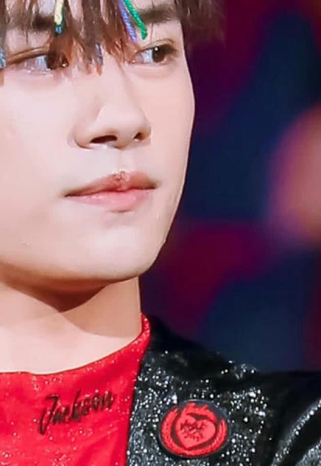 易烊千玺两次出席活动嘴巴上都有这个,暴露了千玺的生活状态