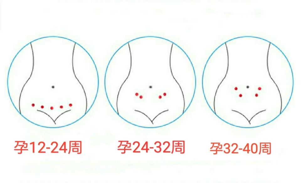 孕32周胎心位置示意图图片