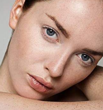 肤色暗沉新生的角质与老化的角质重合,脸上的皮肤白一块黑一块,跟地图