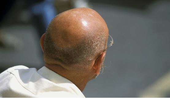 农村俗语:"穷人脚上无毛,富人头顶放光",你听说过吗?