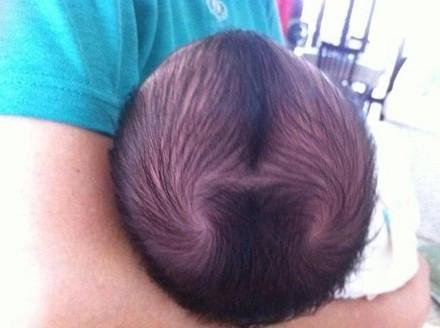 都说头上2个"头旋儿"宝宝更聪明,真是这样吗?