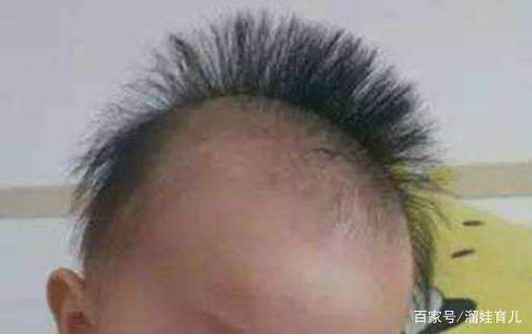 宝宝头发“竖着长”,怎么回事?或许与这3点有关,不妨一看