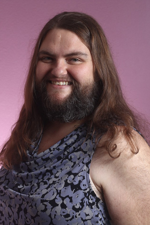 女子青春期开始疯长胡须,少女变成了大汉,现在都懒得剃须了|女子|胡子