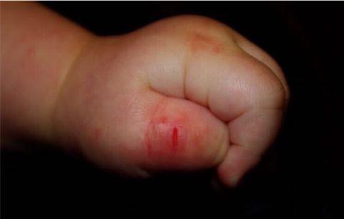 宝宝|吮吸手指|婴儿_新浪新闻