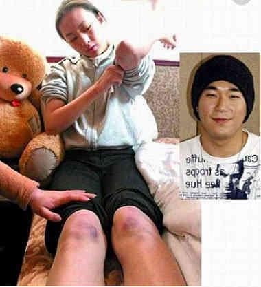 张默吸毒离开后,童瑶如今大放异彩,当年被打内幕曝光|童谣|张默|童瑶