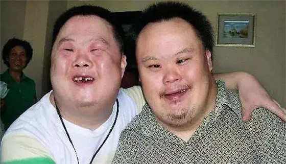 远离唐氏宝宝|三体|唐氏|唐氏综合征_新浪新闻