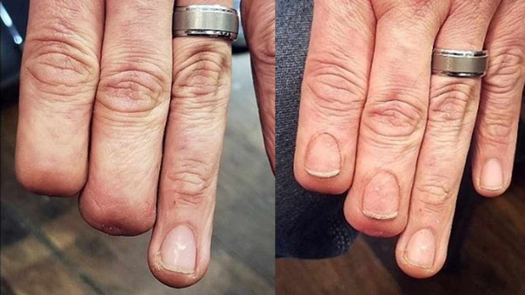 视频纹身师为半截手指的顾客纹上超逼真的指甲