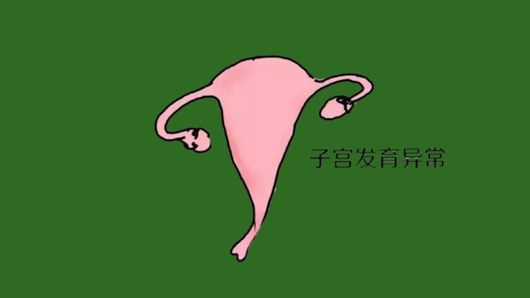 其中子宫畸形包括双子宫,子宫是马鞍形等情况.第三个是子宫的因素.
