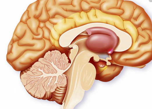 脑干出血原因图片