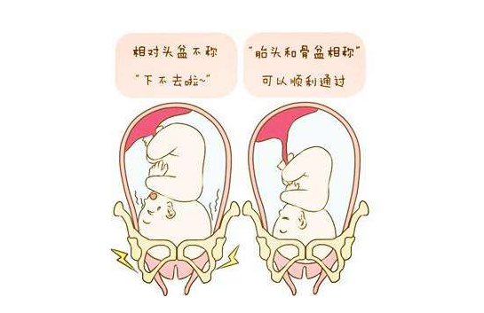 孕妈妈如果发现胎儿心跳下降,有可能是胎儿脐带受压迫,排胎便,胎头