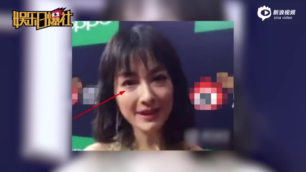 视频：吴昕穿仙女裙大秀美背 过敏脸肿眼袋十分抢镜
