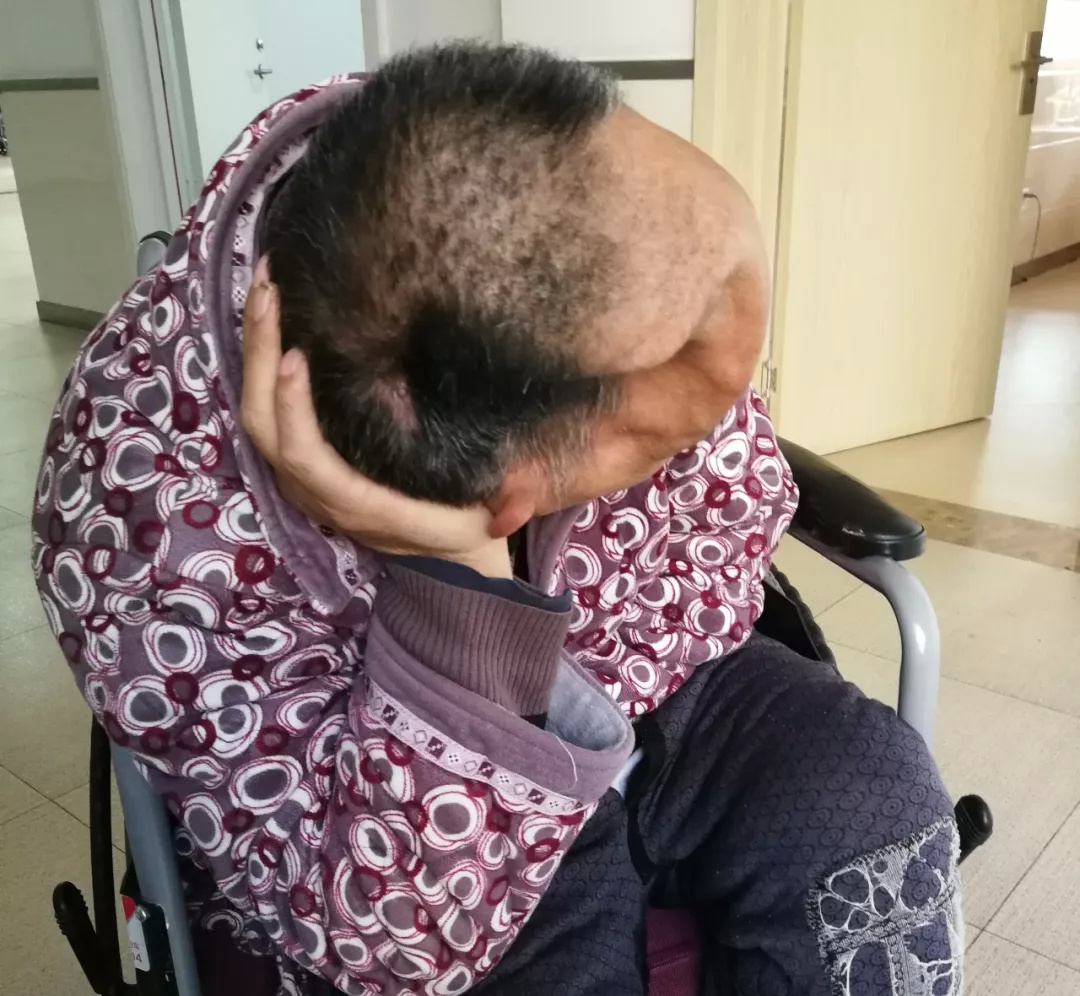 "半脑"老人祈盼无望未来有"微光"