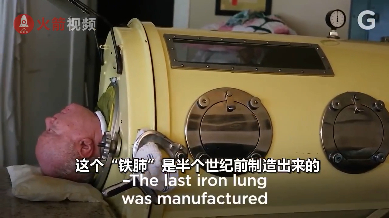 【超励志的"铁肺"老人】美国的paul alexanderl 6岁时患上.