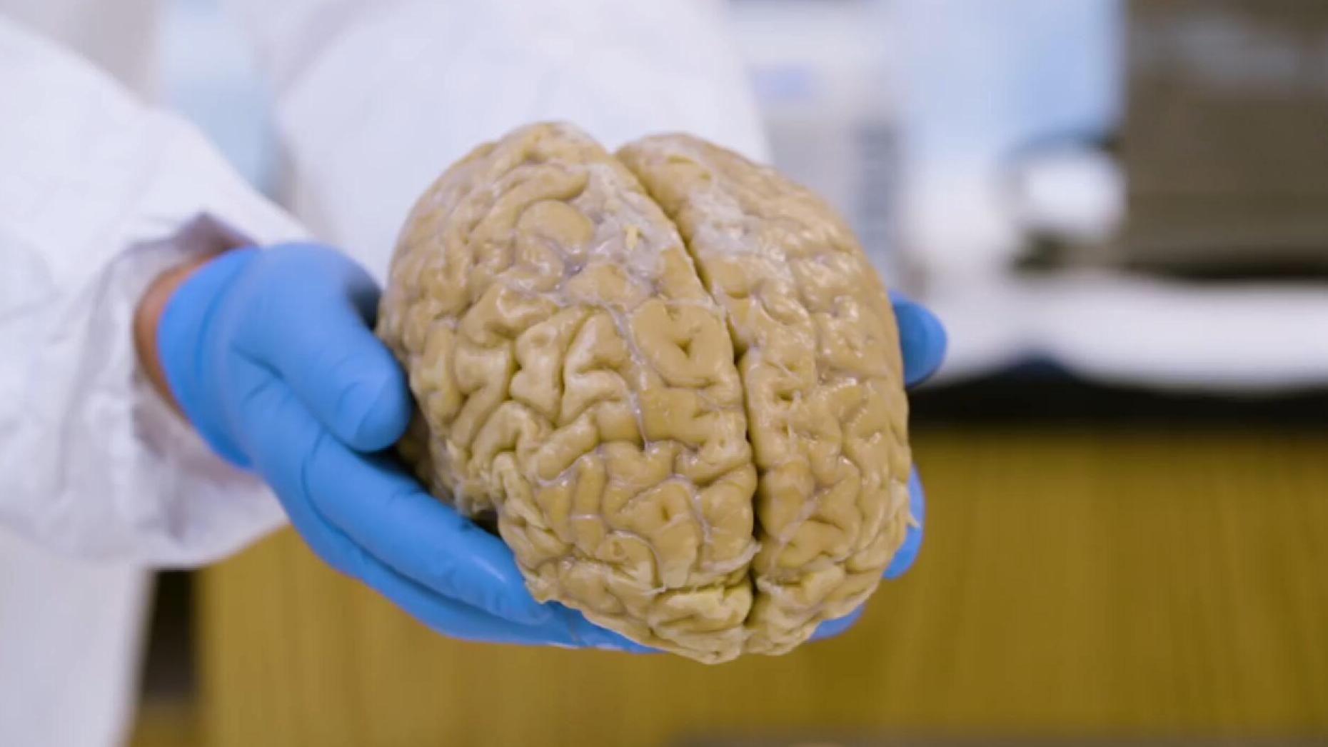 这家特殊的银行,专用来存人类大脑