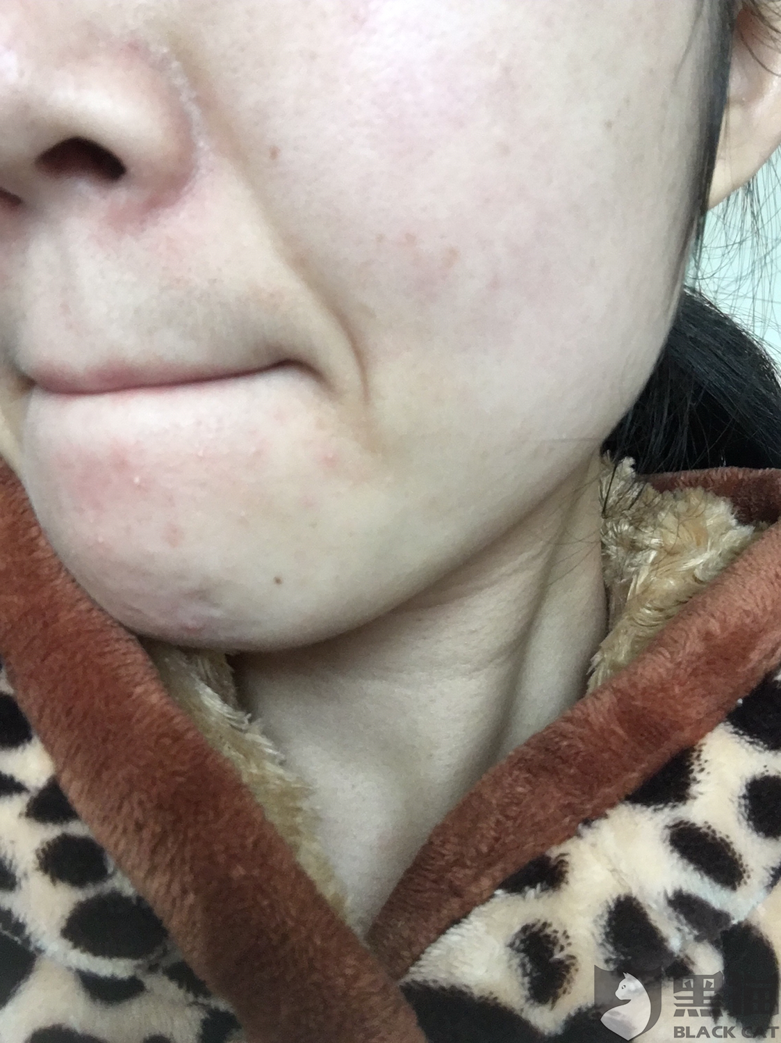 黑猫投诉 屈臣氏 大品牌 销售有问题面膜 屈臣氏 新浪新闻