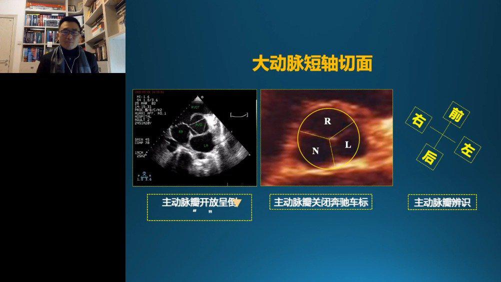 成都中医药大学附属医院孔令秋:超声心动图基本切面及正常值