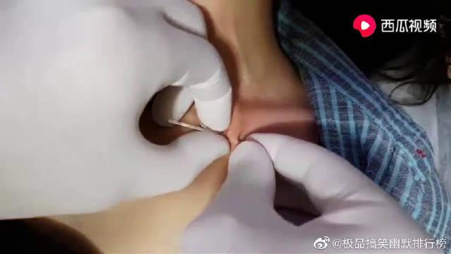 最近"女生打钉"风很大,躲过唇钉和鼻钉,却被锁骨钉惊艳了