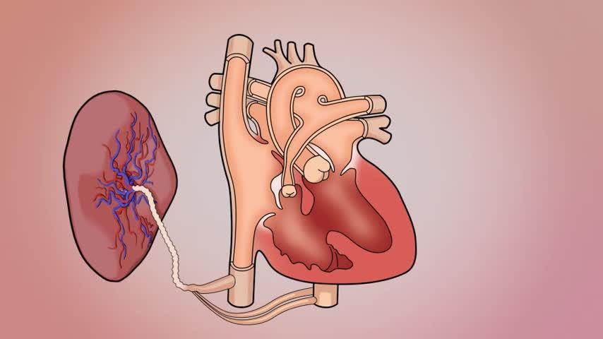 胎儿的血液循环(法洛四联症)