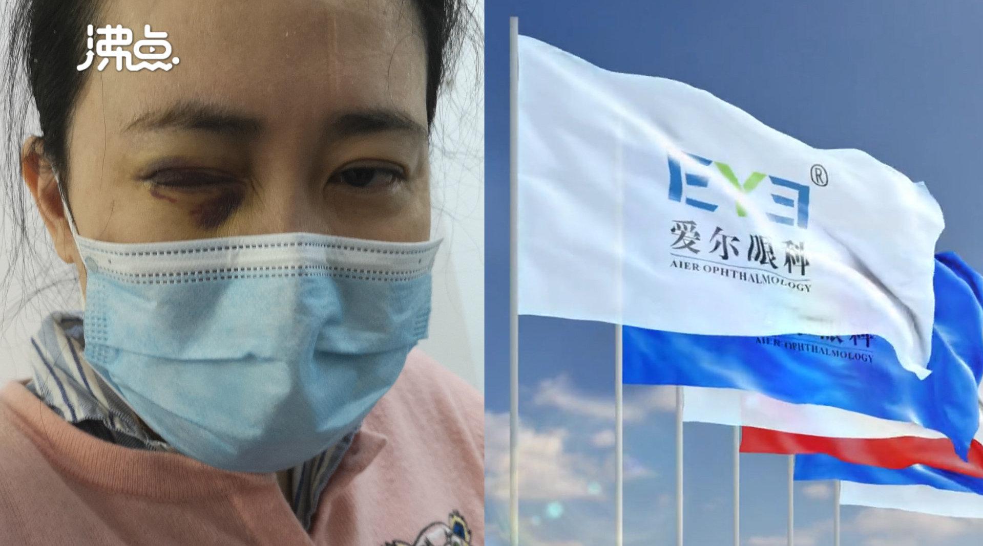 抗疫医生艾芬在爱尔眼科治疗后右眼近乎失明 曾及时发布疫情预警信息