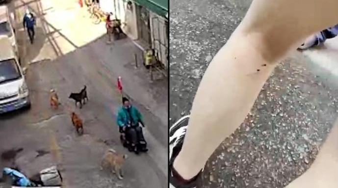 老人遛四条狗不牵绳：女子被咬伤 仅有一条狗有证