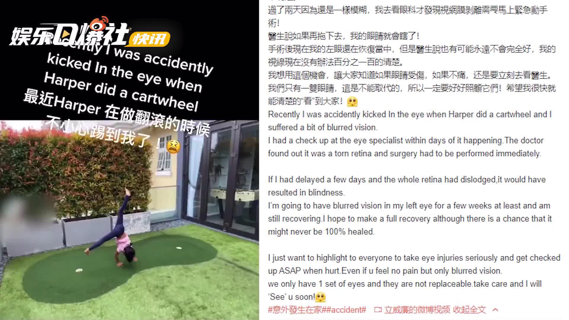 立威廉自曝被女儿误伤眼睛