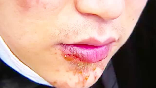 陈赫回应顾客在其火锅店用餐受伤：深表歉意 将在全国门店排查隐患