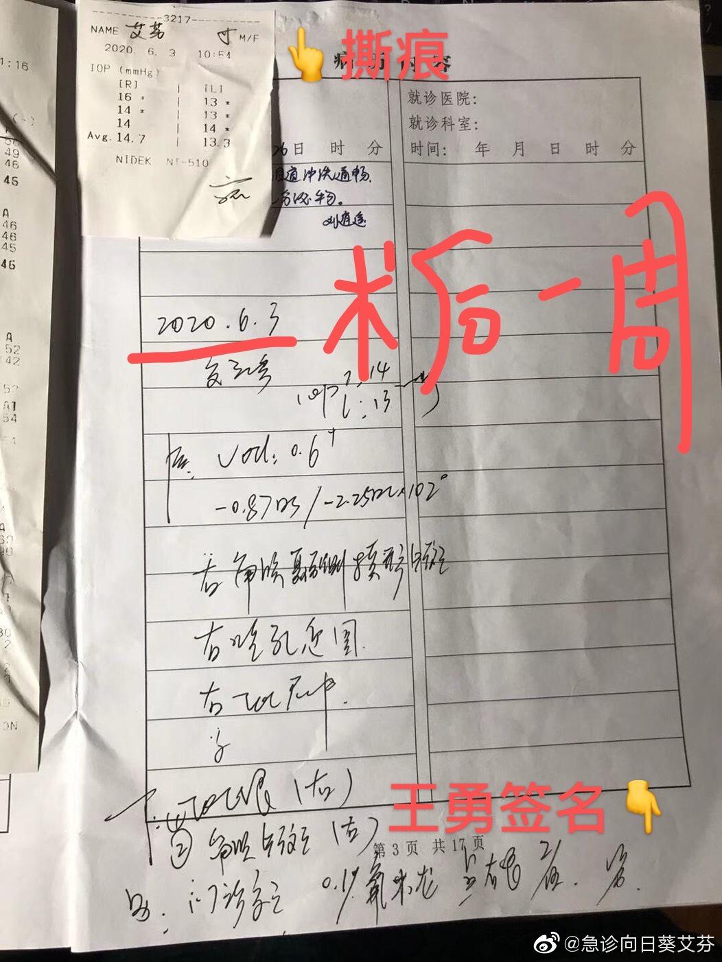 艾芬爱尔眼科把不该做和不能做的手术都扩大化手术这是欺诈