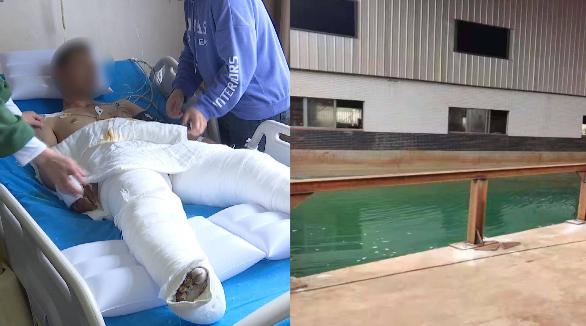 男子送货不慎掉入硫酸亚铁池全身重度烧伤 涉事公司:你马路上摔跤找