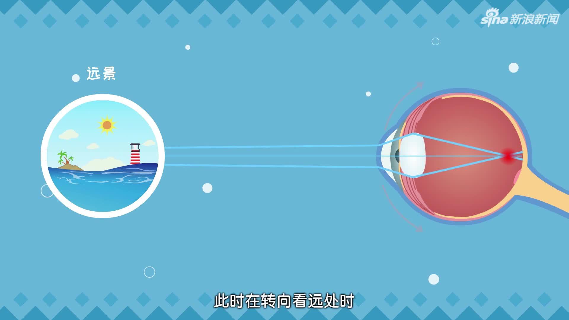 全国爱眼日科普短片第八期什么是假性近视