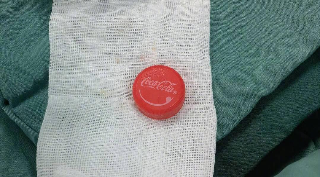 少年牙齿开冰可乐 打开瞬间瓶盖冲进食管