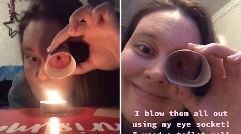 英国34岁女子患病被摘除眼球 用眼球空洞吹蜡烛走红网络_手机新浪网